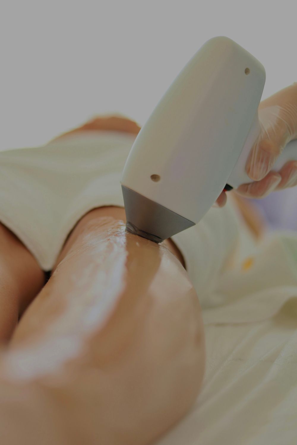 Close-up of laser hair removal procedure.